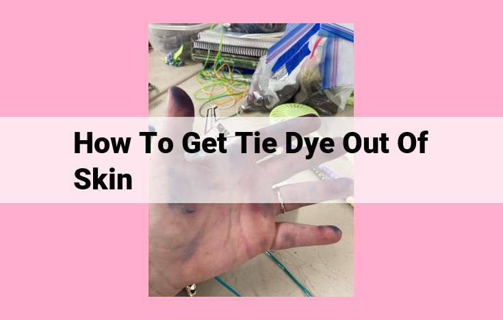 how to get tie dye out of skin